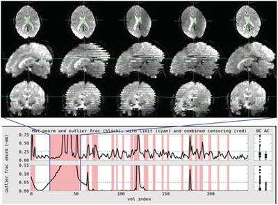 The art and science of using quality control to understand and improve fMRI data